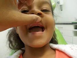 dacosta_kids_dentures_-_2a_15