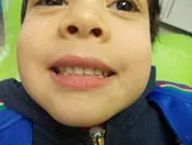 dacosta_kids_dentures_-_4-2_18